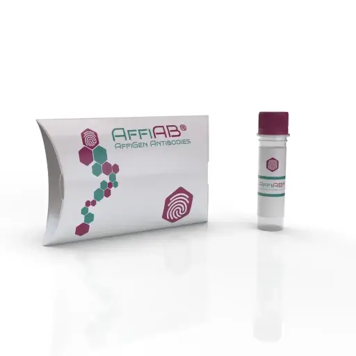 [ABD6424] NOS1 Antibody